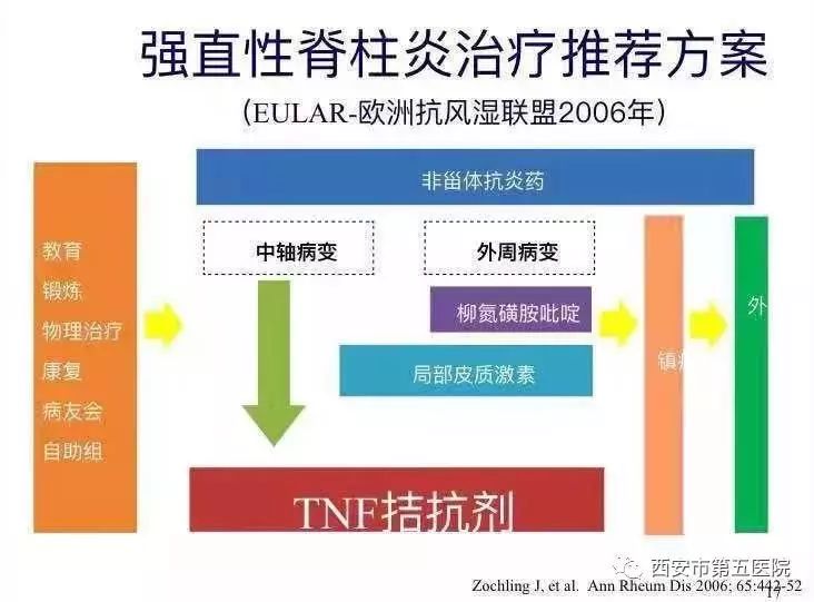 強(qiáng)直性脊柱炎最新進(jìn)展